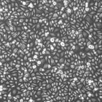 FC-0029, Corneal Epithelial Cells, 10x