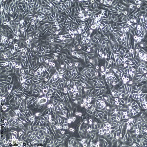Male Mammary Epithelial Cells FC-0063