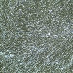 FC-0001, Neonatal Fibroblasts, 10x v2