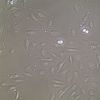 FC-0003 Umbilical Vein Endothelial Cell, 20X