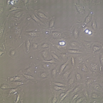 FC-0003 Umbilical Vein Endothelial Cell, 20X