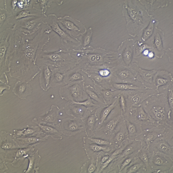 FC-0003 Umbilical Vein Endothelial Cell, 20X
