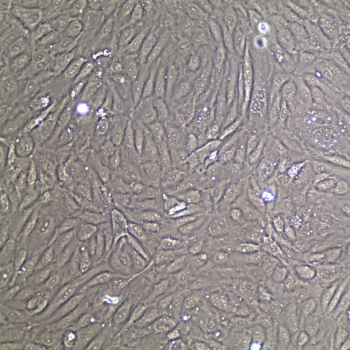FC-0003 Umbilical Vein Endothelial Cell, 20X Confluent