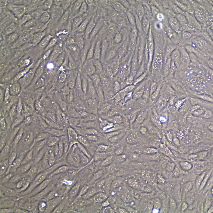 HUVEC Primary Cells