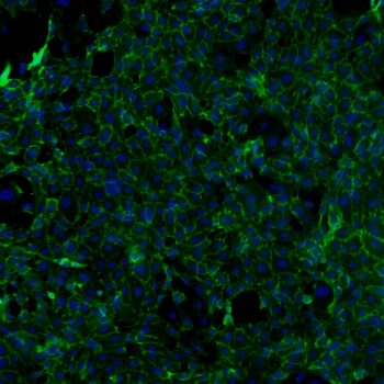 FC-0003-Umbilical-Vein-Endothelial-Cells-10X-stained-Anti-CD31-DAPI