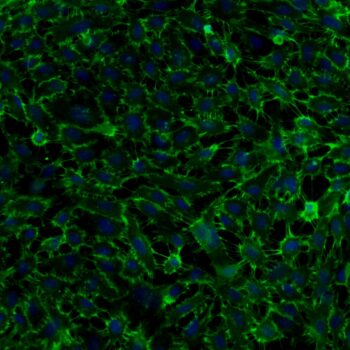FC-0003-Umbilical-Vein-Endothelial-Cells-20X-stained-Anti-CD31-DAPI