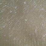 FC-0020 Wharton's Jelly Mesenchymal Stem Cells, 10X, Confluent