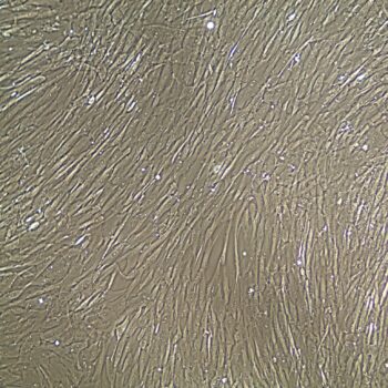 FC-0020 Wharton's Jelly Mesenchymal Stem Cells, 10X, Confluent