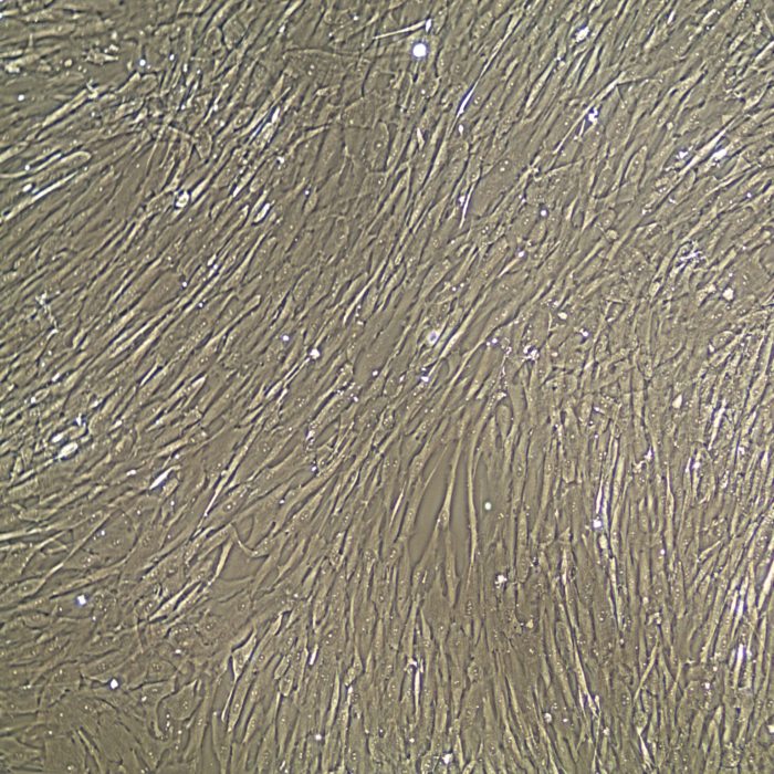 Whartons Jelly Human Mesenchymal Stem Cells