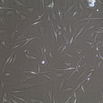 FC-0023 Neonatal Melanocyte, 20X