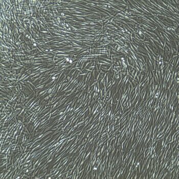 FC-0024, Adult Fibroblasts, 10x