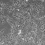 Coronary Artery Smooth Muscle Cells FC-0031