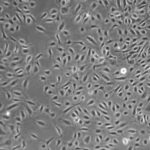 Coronary Artery Endothelial Cells 10X FC-0032