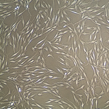 Human Adult Mesenchymal Stem Cells