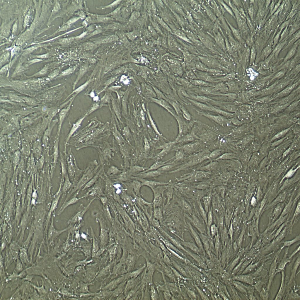 Human Adult Mesenchymal Stem Cells