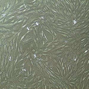 FC-0034, Adipose Mesenchymal Stem Cells, 10x