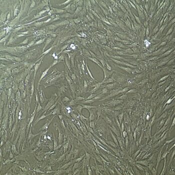 FC-0034, Adipose Mesenchymal Stem Cells, 10x