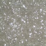 FC-0035 Bronchial-Tracheal Epithelial Cells, 10x