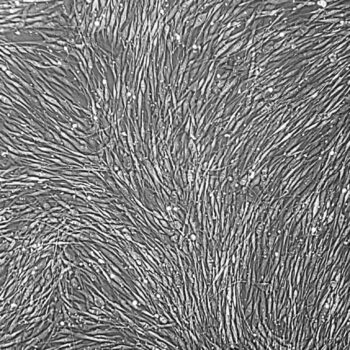 FC-0037, Xeno-Free Neonatal Fibroblasts, 10x