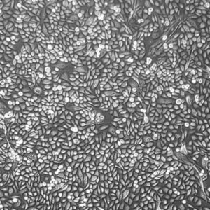 Primary Human Prostate Epithelial Cells