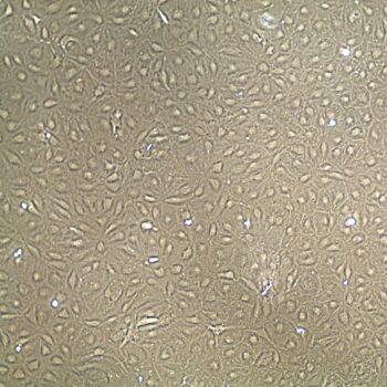 FC-0042 Neonatal Microcascular Endothelial Cells, 10X, confluent