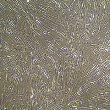 FC-0043 Bladder Smooth Muscle Cell, 10, confluent