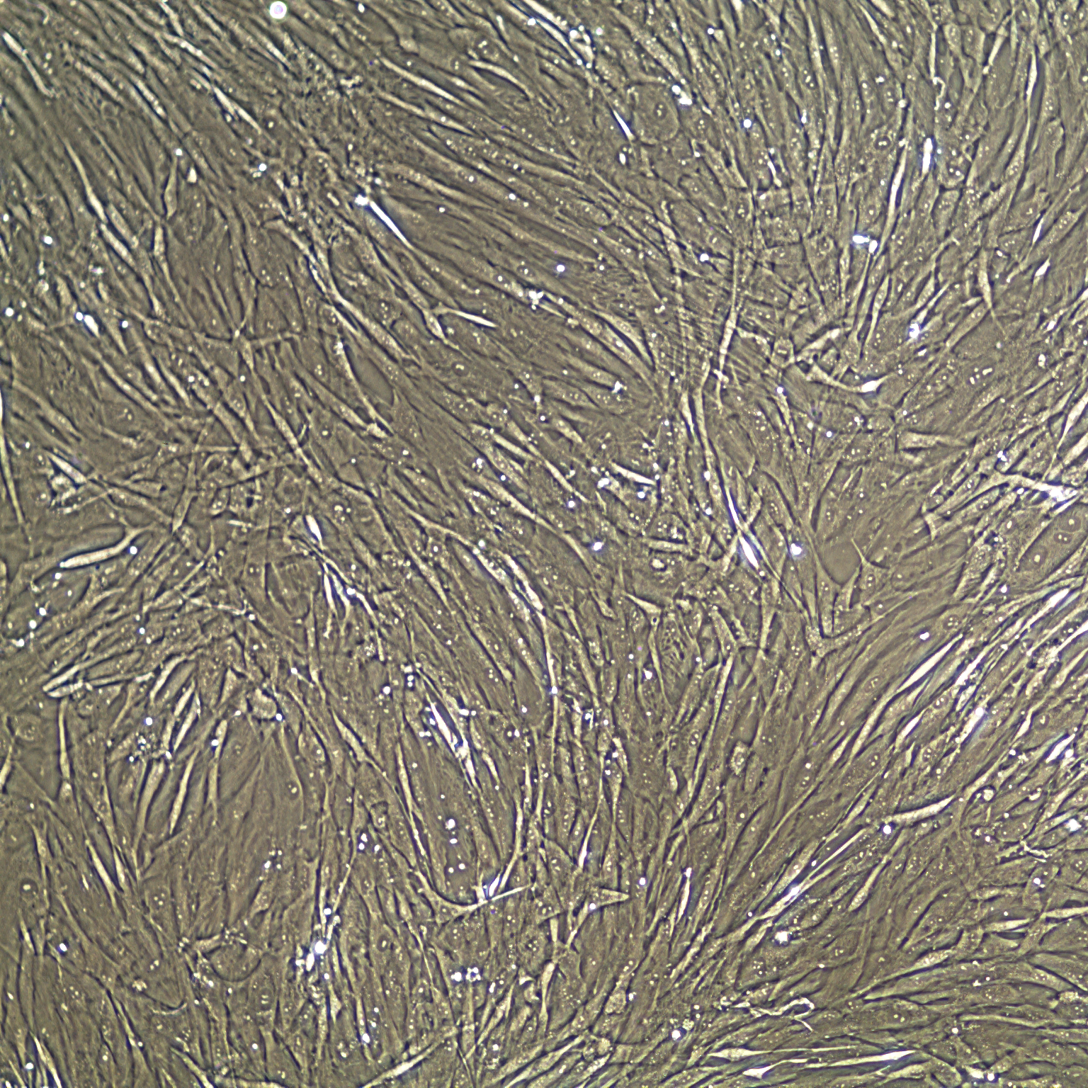 Normal Human Bladder Smooth Muscle Cells, Primary
