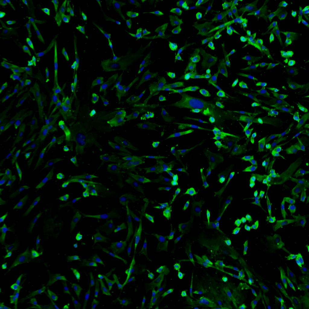 Primary Human Bladder Smooth Muscle Cells