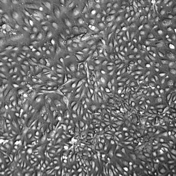 FC-0044, Pooled Umbilical Vein Endothelial Cells (HUVEC), 10x