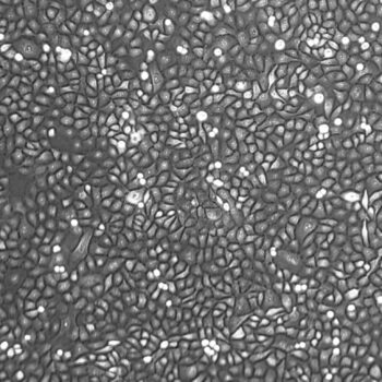 FC-0048, Seminal Vesicle Epithelial Cells, 10x