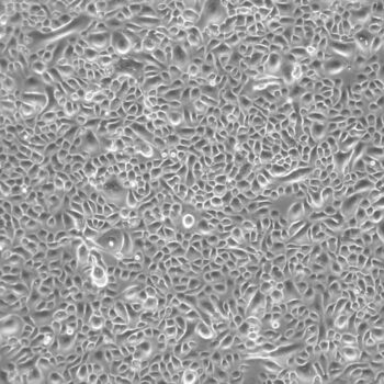 Human Lobar Bronchial Epithelial Cells 10x