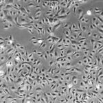 Pulmonary Artery Endothelial Cells 10x FC-0055