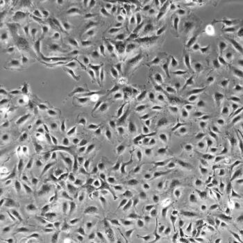 Pulmonary Artery Endothelial Cells 10x FC-0055