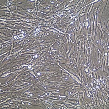 Pulmonary Artery Smooth Muscle Cells 20x FC-0056