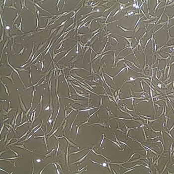 FC-0057 Bone Marrow Mesenchymal Stem Cells, 10X, Non Confluent