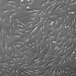 FC-0062, Pre-Adipocytes, 10x