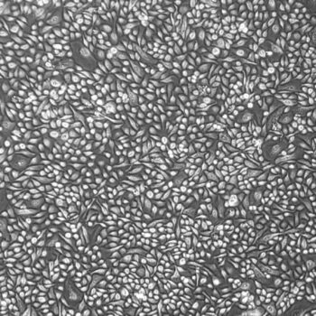 FC-0065, Mammary Epithelial Cells, 10x