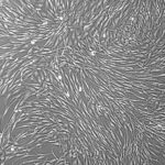 FC-0076, Uterine Fibroblasts, 10x