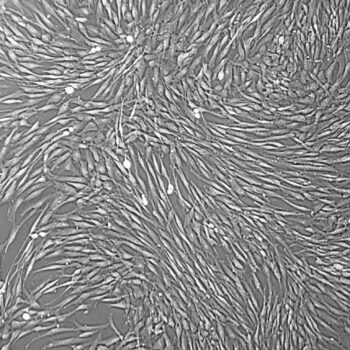 FC-0076, Uterine Fibroblasts, 10x