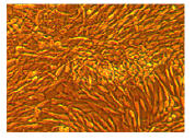 Human Bladder Fibroblasts grown in FibroLife S2 Medium, (100X)