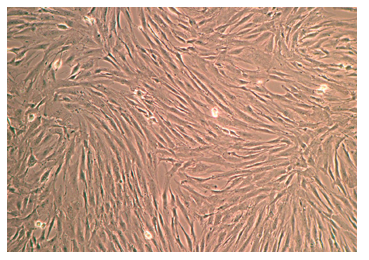 bone marrow mesenchymal stem cells medium