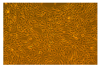 chondrogenesis complete medium