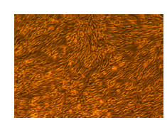 Human Dermal Fibroblasts-Neonatal, passage 2, 5 days after inoculation with 2000 cells/cm2 (100X)