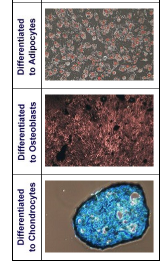 Mesenchymal Stem Cell Pre-Adipocyte Differentiation