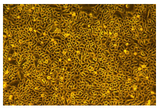 prostate epithelial culture medium