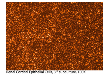 Renal Cortical Epithelial Cell Culture