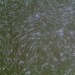 FC-0095 Human Gingival Fibroblasts, 10x