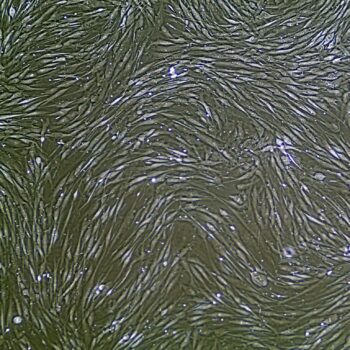 FC-0095 Human Gingival Fibroblasts, 10x