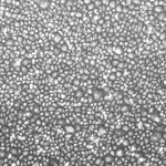 FC-0078, Endometrial (Uterine) Epithelial Cells, 10x