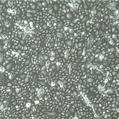 Endometrial Uterine Epithelial Cells